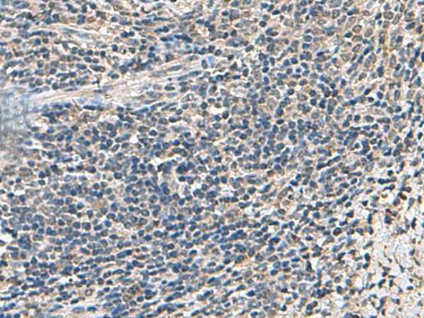 Anti-Human/Mouse/Rat ATP5F1D Antibody