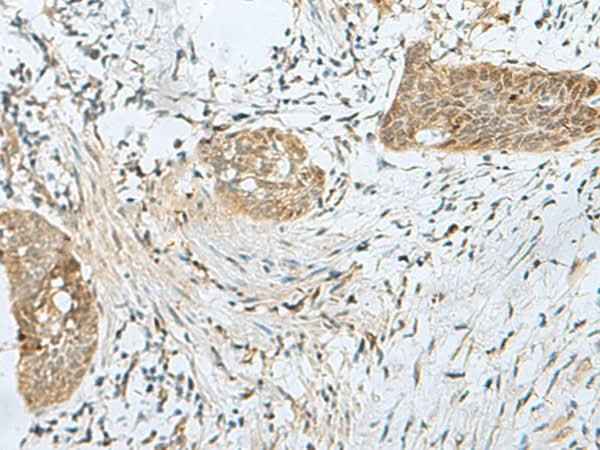 Anti-Human/Mouse SNRPD1 Antibody