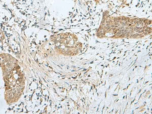 Anti-Human/Mouse SNRPD1 Antibody