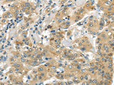 Anti-Human UTS2B Antibody - ABMIUM