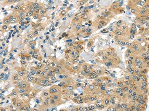 Anti-Human UTS2B Antibody