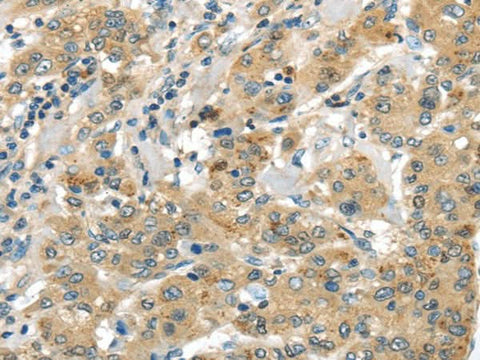Anti-Human UTS2B Antibody - ABMIUM