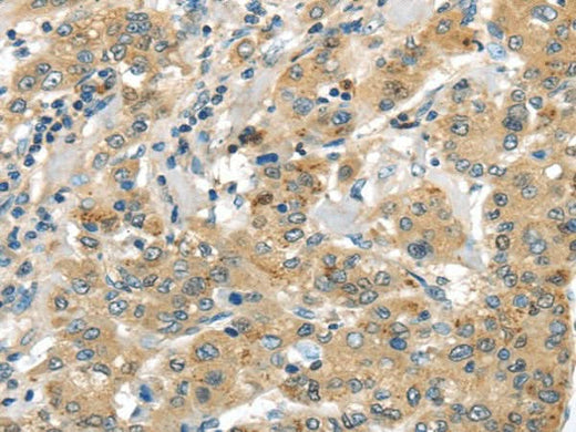Anti-Human UTS2B Antibody - ABMIUM