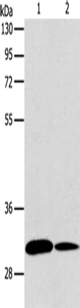 Anti-Human/Mouse/Rat ATG5 Antibody - ABMIUM