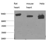 Western Blot analysis of 1) Rat heart, 2) Mouse heart, 3) Hela using STAT3 Monoclonal Antibody at dilution of 1:2000.