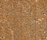 Anti-Human/Mouse/Rat ST18 Antibody - ABMIUM