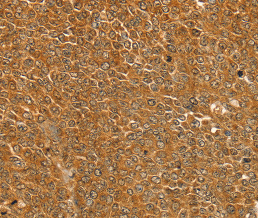 Anti-Human/Mouse/Rat ST18 Antibody - ABMIUM