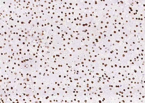 Anti-Human PCNA Antibody [B344] - ABMIUM