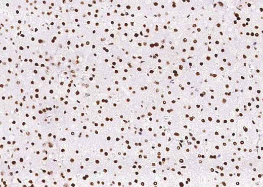 Anti-Human PCNA Antibody [B344] - ABMIUM