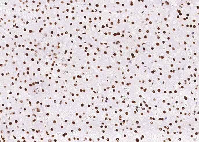 Anti-Human PCNA Antibody [B344]