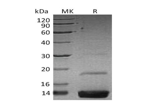 Recombinant Human Resistin Protein (His Tag) - ABMIUM