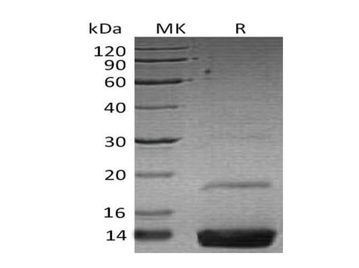 Recombinant Human Resistin Protein (His Tag) - ABMIUM