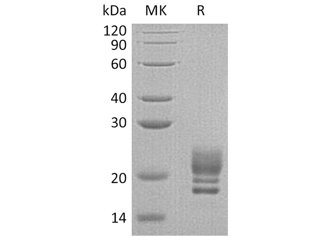 Recombinant Human COQ7 Protein (His Tag) - ABMIUM