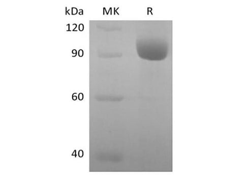 Recombinant Human Leukocyte Ig-Like Receptor A3/LILRA3/ILT6/CD85e (C-Fc) - ABMIUM