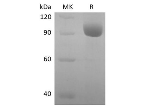 Recombinant Human Leukocyte Ig-Like Receptor A3/LILRA3/ILT6/CD85e (C-Fc) - ABMIUM