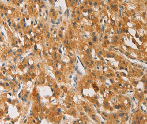 Anti-Human/Mouse ATG4D Antibody - ABMIUM