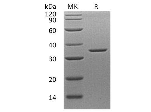 Recombinant Human Annexin A8/ANXA8 Protein - ABMIUM