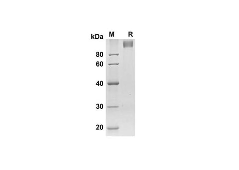 SDS-PAGE analysis of Mouse SELP proteins, 2 μg/lane of Recombinant Mouse SELP proteins was resolved with SDS-PAGE under reducing conditions, showing bands at 98.3 kDa.