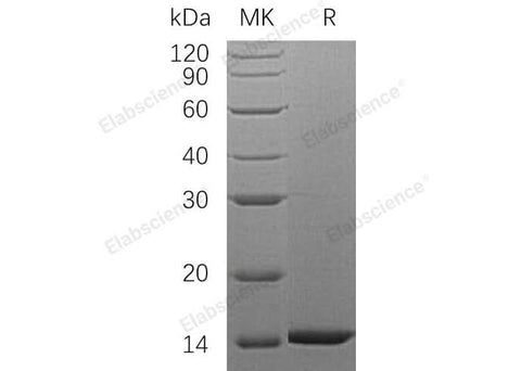 Recombinant Human HDGF Protein (His Tag) - ABMIUM
