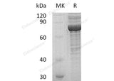 Recombinant Human PRKG1 Protein (His Tag) - ABMIUM