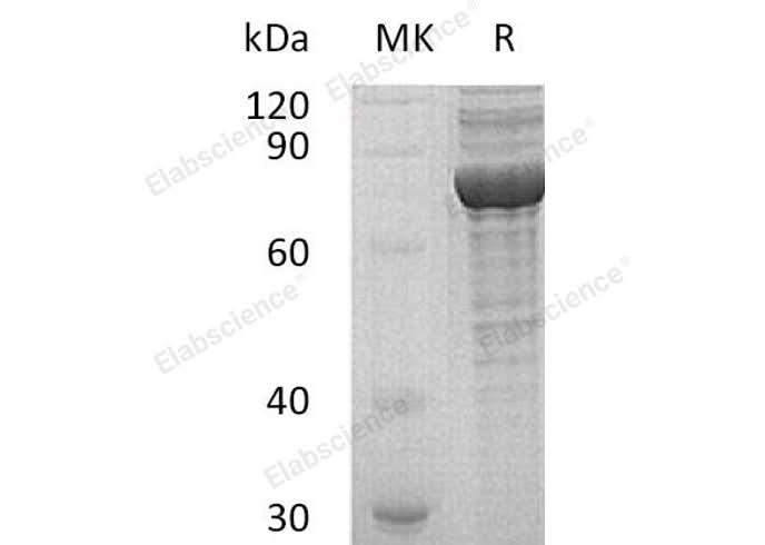 Recombinant Human PRKG1 Protein (His Tag) - ABMIUM
