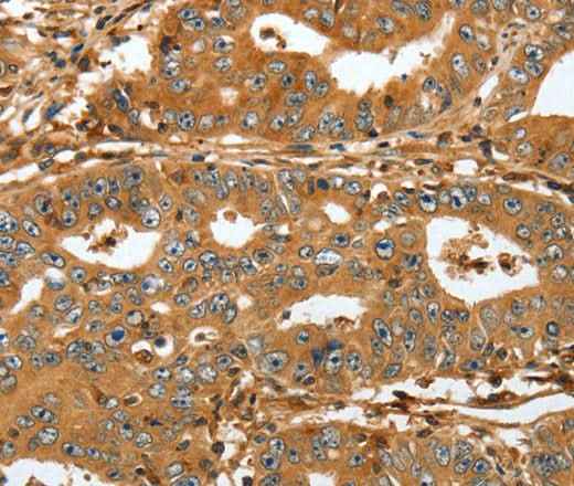 Anti-Human/Mouse/Rat RAP1A Antibody