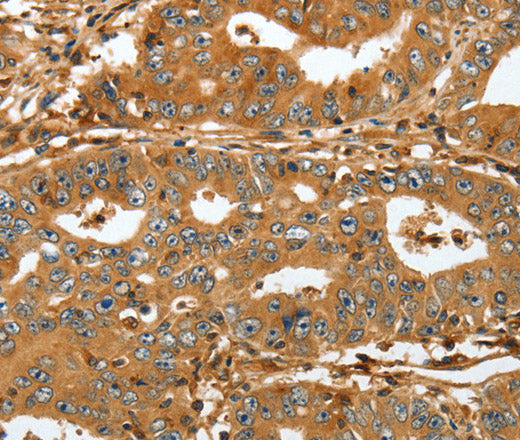 Anti-Human/Mouse/Rat RAP1A Antibody - ABMIUM