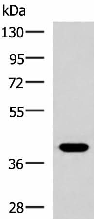 Western blot analysis of HepG2 cell lysate using PLPPR5 Polyclonal Antibody at dilution of 1:1500