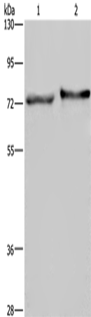 Anti-Human/Mouse TRIM29 Antibody - ABMIUM
