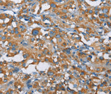 Anti-Human KLF7 Antibody - ABMIUM