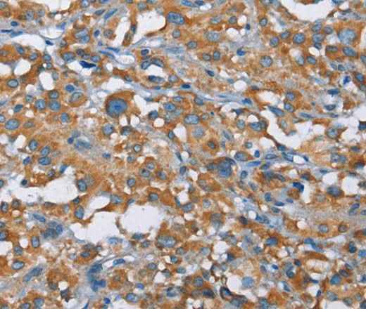 Anti-Human KLF7 Antibody