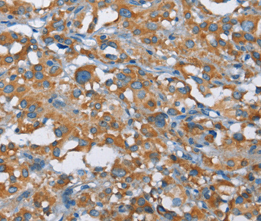 Anti-Human KLF7 Antibody - ABMIUM