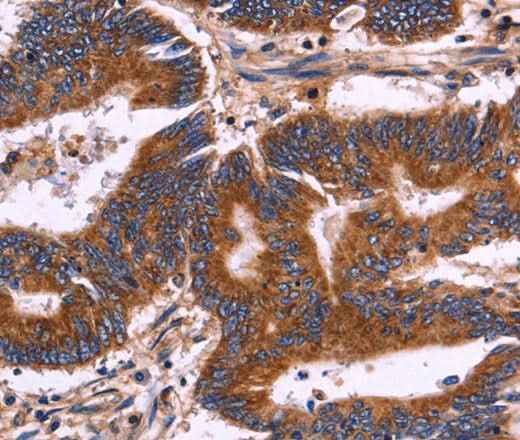 Anti-Human KIR2DL1/3/4/S4 Antibody