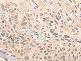 Anti-Human/Mouse HIPK2 Antibody - ABMIUM