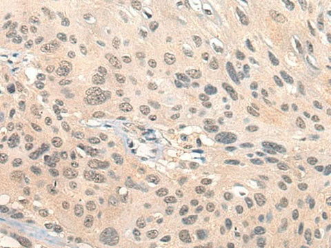 Anti-Human/Mouse HIPK2 Antibody - ABMIUM