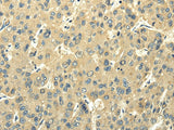 Anti-Human/Mouse PMP2 Antibody - ABMIUM