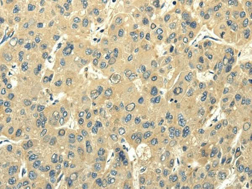 Anti-Human/Mouse PMP2 Antibody - ABMIUM