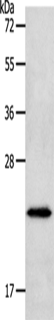 Anti-Human/Mouse NEUROG1 Antibody - ABMIUM