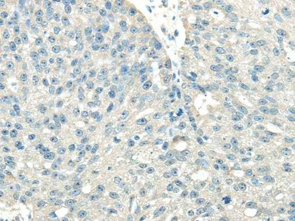 Anti-Human/Mouse/Rat VPS36 Antibody