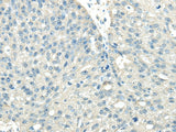 Anti-Human/Mouse/Rat VPS36 Antibody - ABMIUM