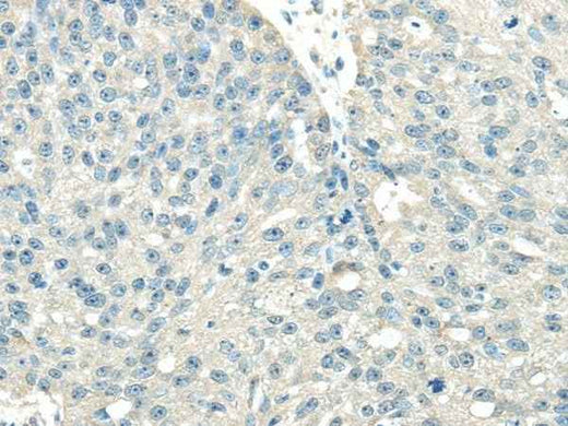 Anti-Human/Mouse/Rat VPS36 Antibody