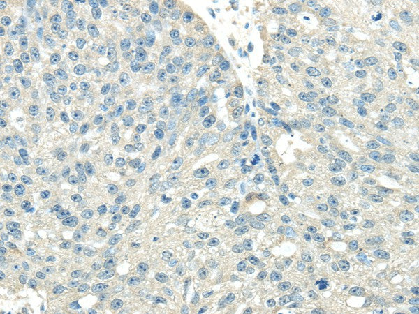 Anti-Human/Mouse/Rat VPS36 Antibody - ABMIUM