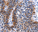 Anti-Human/Mouse RAB25 Antibody - ABMIUM