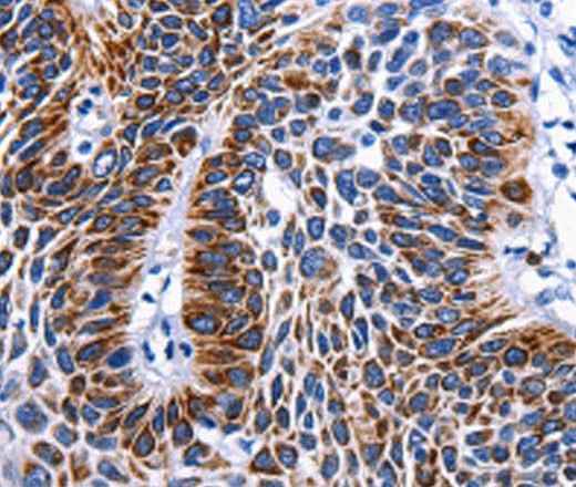 Anti-Human/Mouse RAB25 Antibody