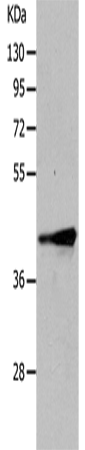 Anti-Human TRIM63 Antibody - ABMIUM