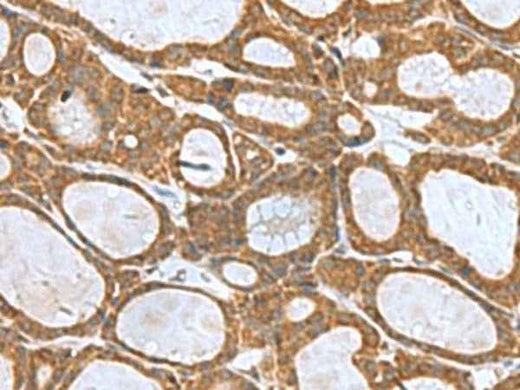 Anti-Human/Mouse/Rat KIF2A Antibody