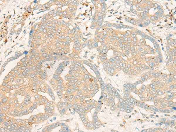 Anti-Human/Mouse/Rat FBXO32 Antibody