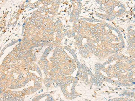 Anti-Human/Mouse/Rat FBXO32 Antibody