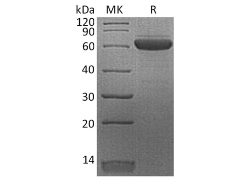 Recombinant Human Erythropoietin R/EPOR Protein (Fc Tag) - ABMIUM