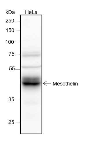 Anti-Human Mesothelin Antibody [A303] - ABMIUM